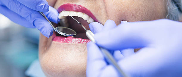 Best Emergency Treatment for Dental Infections or Abscesses in Oologah, OK